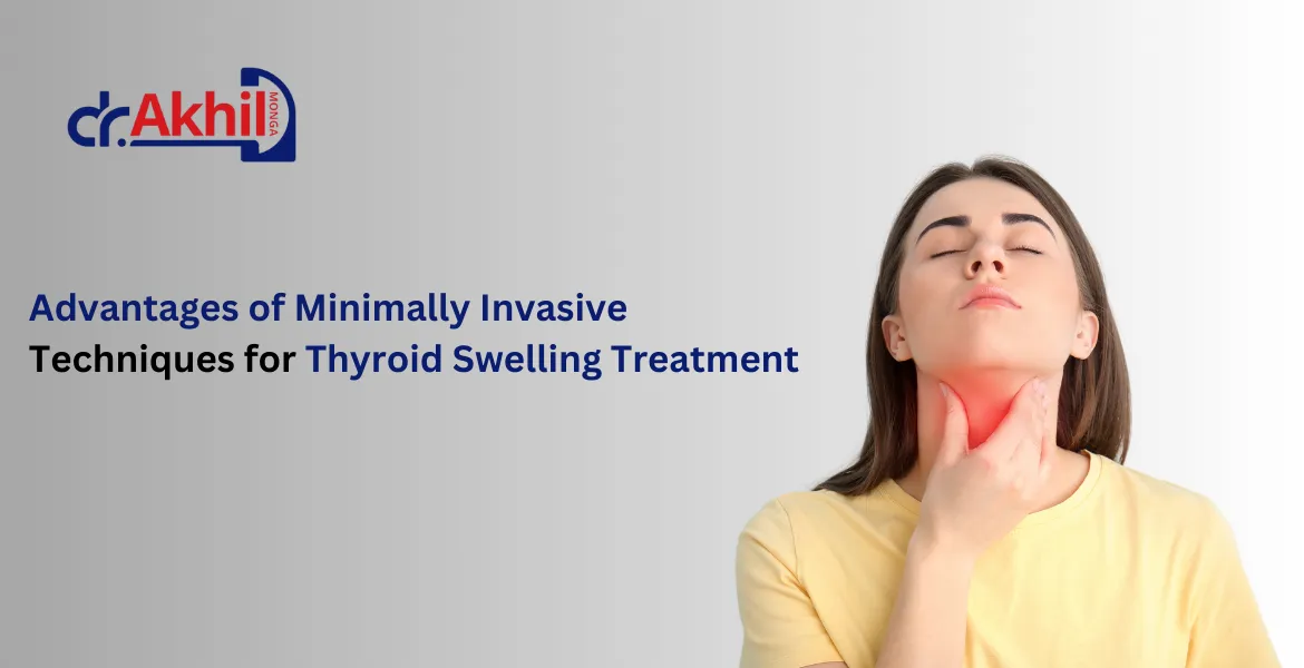 Advantages of Minimally Invasive Techniques for Thyroid Swelling Treatment